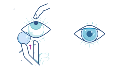 Placement-Technique kodak lens vision centres eyetrust eyecare